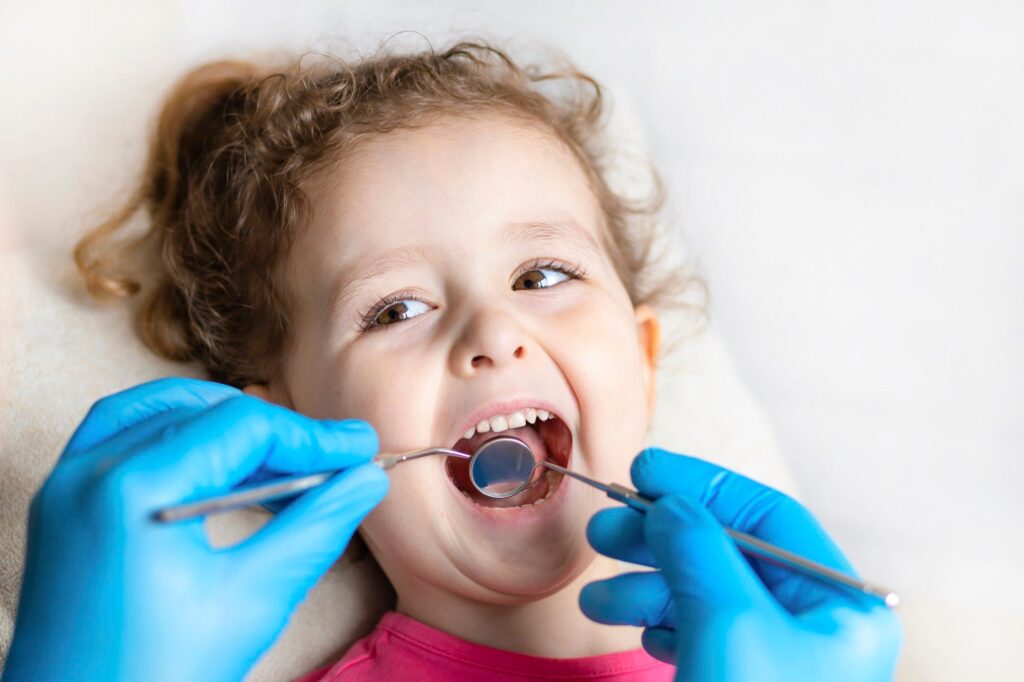 Caries bij kinderen een onderschatte infectieziekte